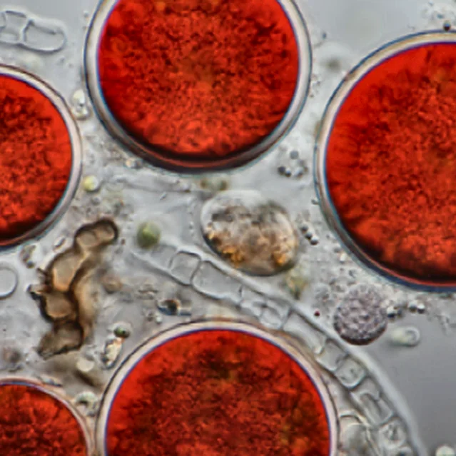 Haematococcus pluvialis cells under the microscope